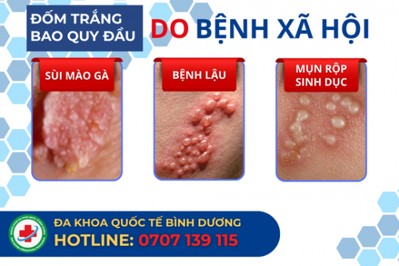 DOM-TRANG-BQD.png