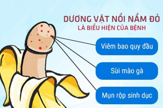 duong-vat-noi-man-do.jpg
