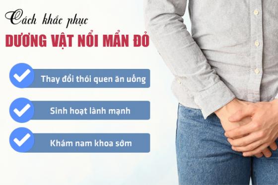 duong-vat-noi-man-do-2.jpg