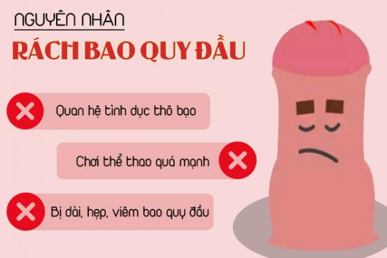 rach-bao-quy-dau-1.jpg