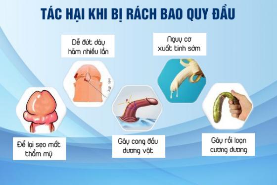 rach-bao-quy-dau.jpg