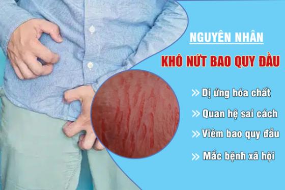 kho-nut-bao-quy-dau-1.jpg