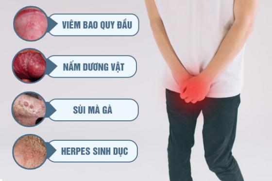 bao-quy-dau-noi-man-1.jpg