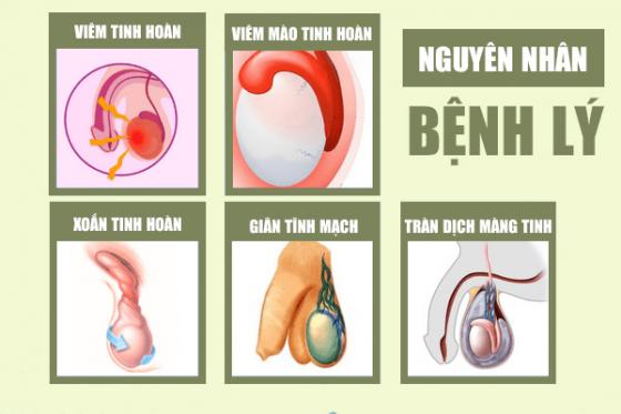 1758688197540613.jpg dau-tinh-hoan-o-nam-3.jpg