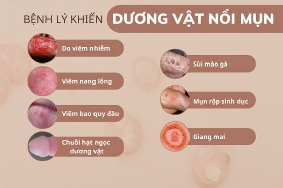 1758703819158809.jpg duong-vat-noi-mun-o-nam.jpg