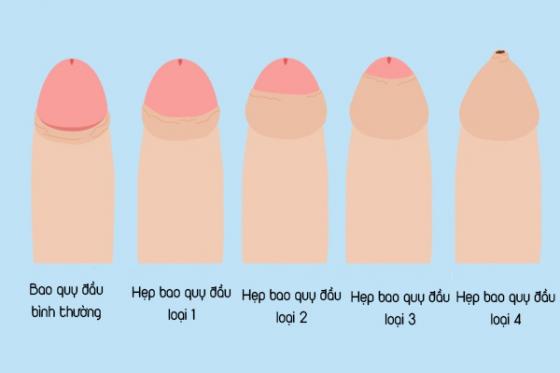 1758792177318001.jpg hep-bao-quy-dau-o-nam-3.jpg