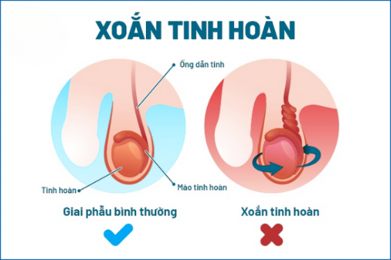 dieu-tri-benh-hieu-qua (90).png